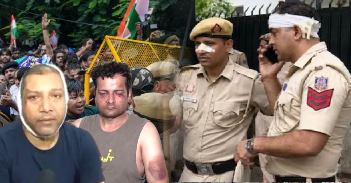 जंतर-मंतर हिंसा: घायल पुलिस अधिकारियों ने सुनाई आपबीती, कहा- भीड़ का निशाना थे हम