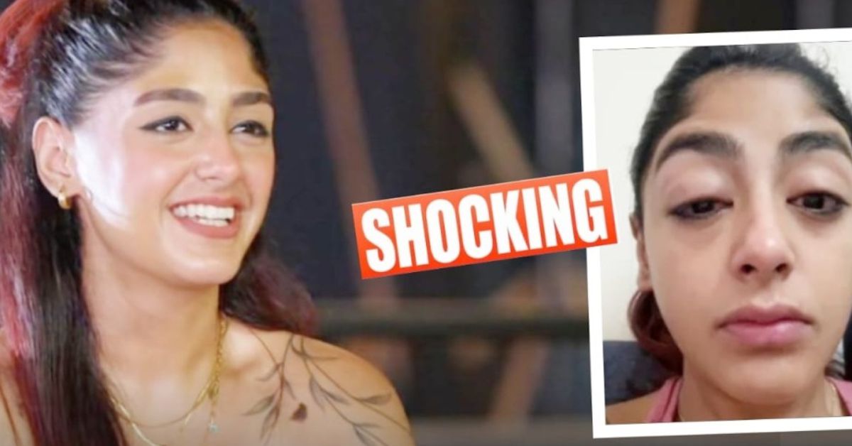 स्प्लिट्सविला 16 की कंटेस्टेंट प्रीत सिंह पर मुंबई क्लब में हमला, दांत टूटा और चेहरा सूजा, वीडियो वायरल   