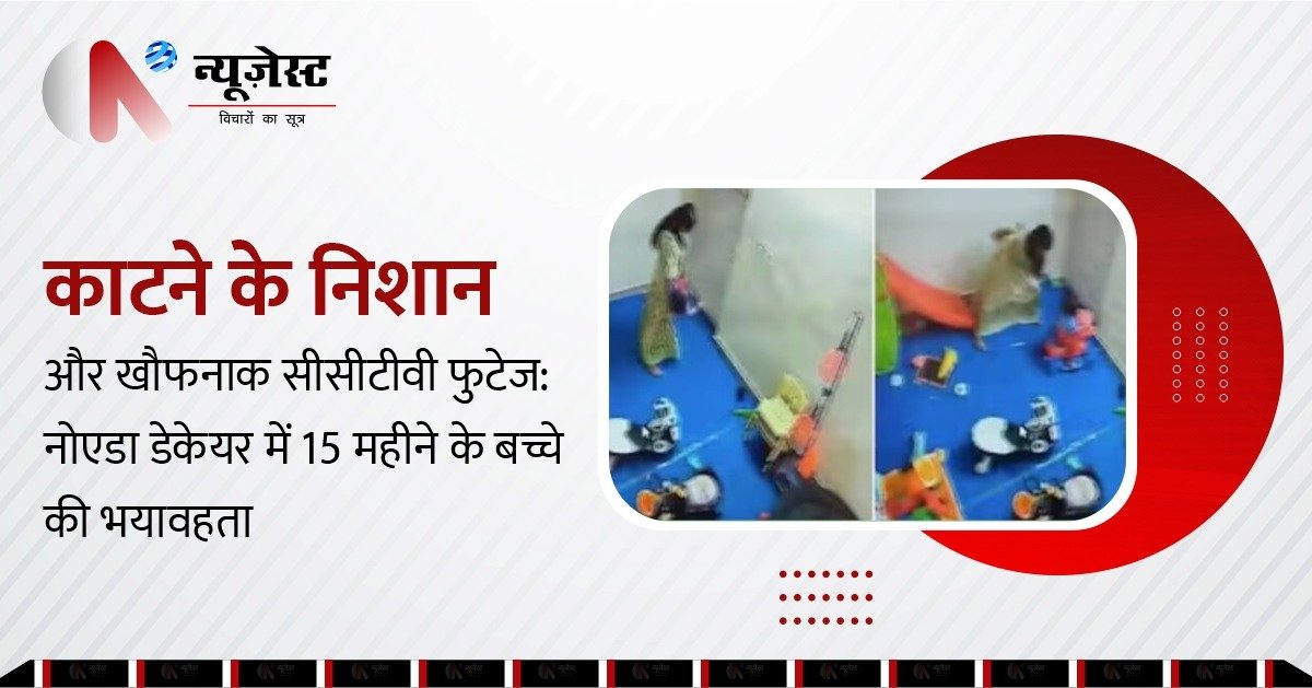 15 महीने की बच्ची के साथ मारपीट, बाइट मार्क्स देख कांप गए मां-बाप